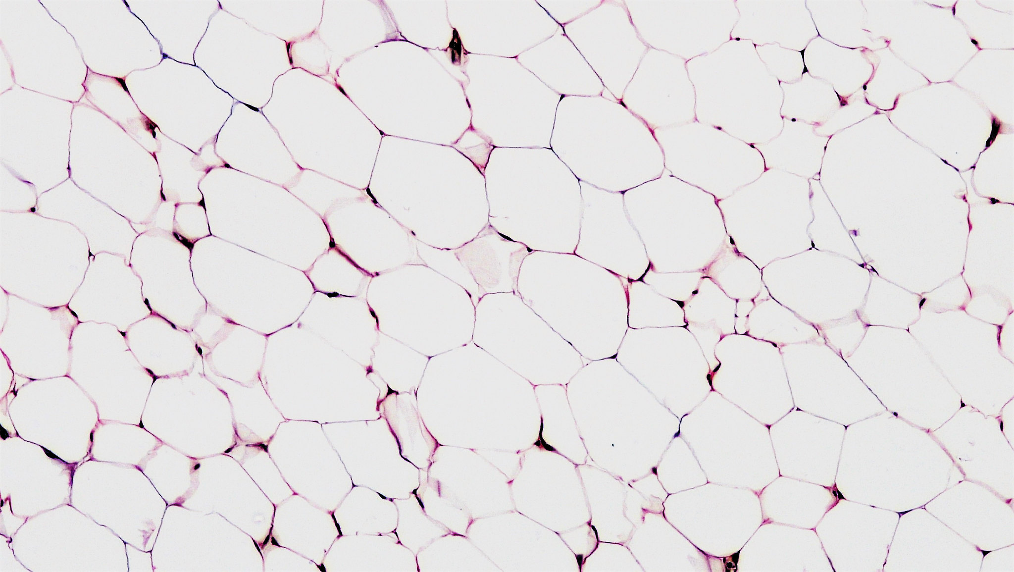Adipose Tissue Stem Cells